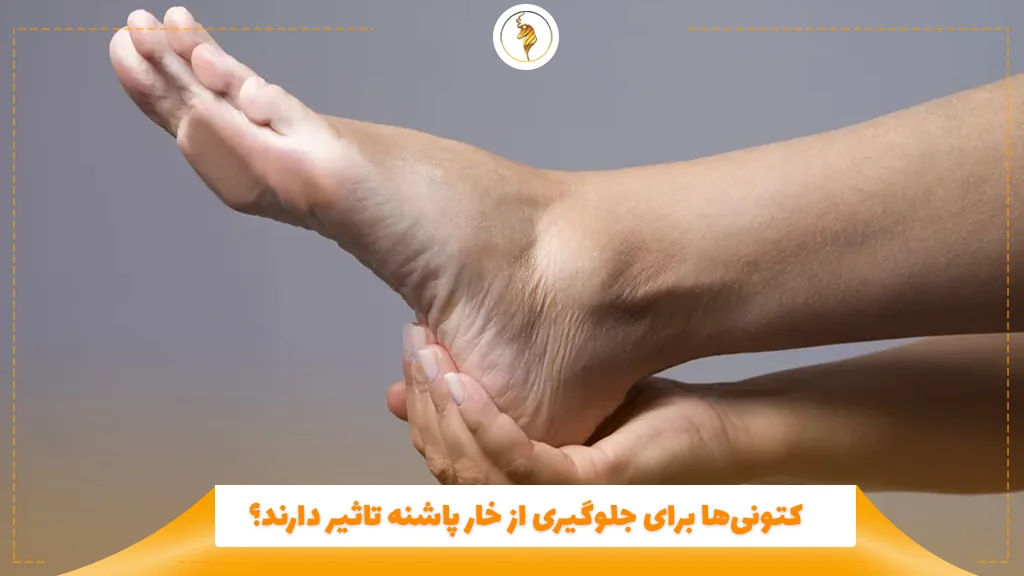 کتونیها برای جلوگیری از خار پاشنه تاثیر دارند؟