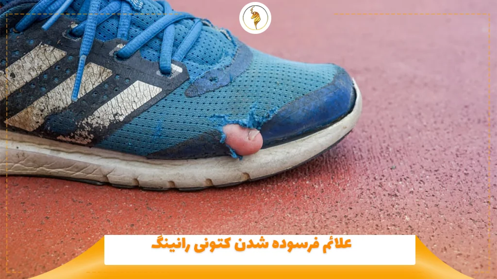 علائم فرسوده شدن کتونی رانینگ